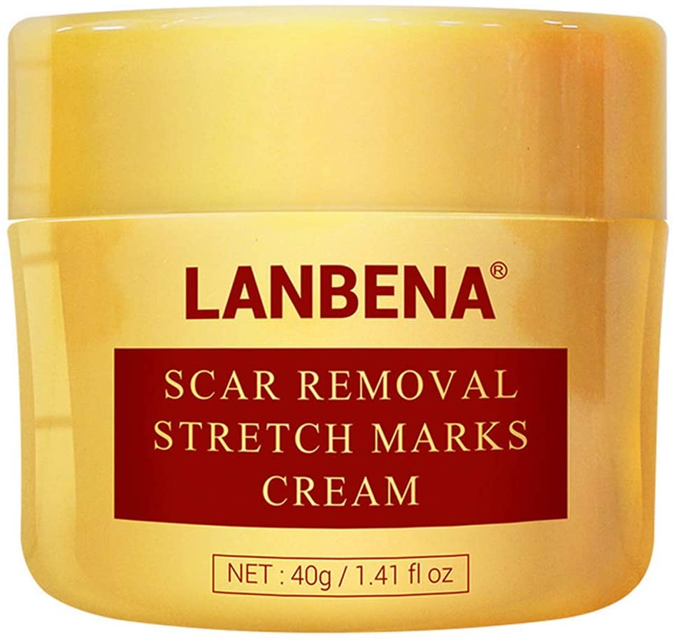 Lanbena Scar Removal Stretch Marks Cream is The Best stretch mark cream for thighs, What is the Best Stretch Mark Cream in Singapore?, 10 Best Stretch Mark Creams in Singapore, Which cream is best to remove stretch marks?,Can creams remove stretch marks?,Can you actually remove stretch marks?,What can clear stretch marks?,10 Best Stretch Mark Creams for Removal and Prevention, stretch mark cream for pregnancy, How do you get rid of stretch marks on your thighs?,Do stretch marks on thighs go away?,What is the best stretch mark cream for legs?,How long does it take for stretch marks to fade on thighs?
